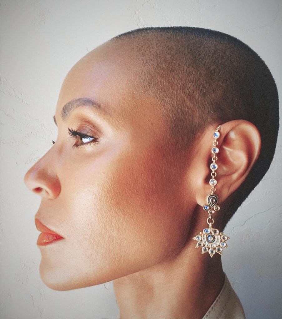 Alopecia: a doença que tirou o cabelo a Jada Smith