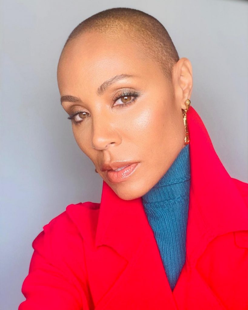 Alopecia: a doença que tirou o cabelo a Jada Smith