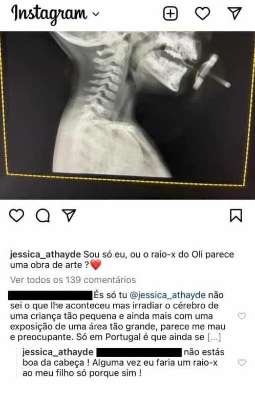 Jessica Athayde respondeu à letra a um internauta que a criticou depois de partilhar uma fotografia de um raio-x do filho, Oliver.