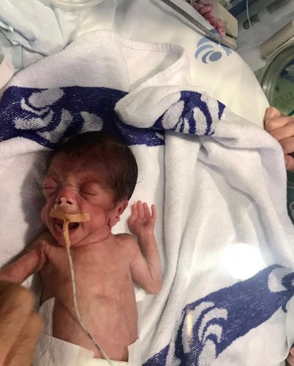 Amoor e Valentine nasceram aos seis meses de gestação. Agora, Luciana Abreu revelou, pela primeira vez, que uma das filhas nasceu morta.